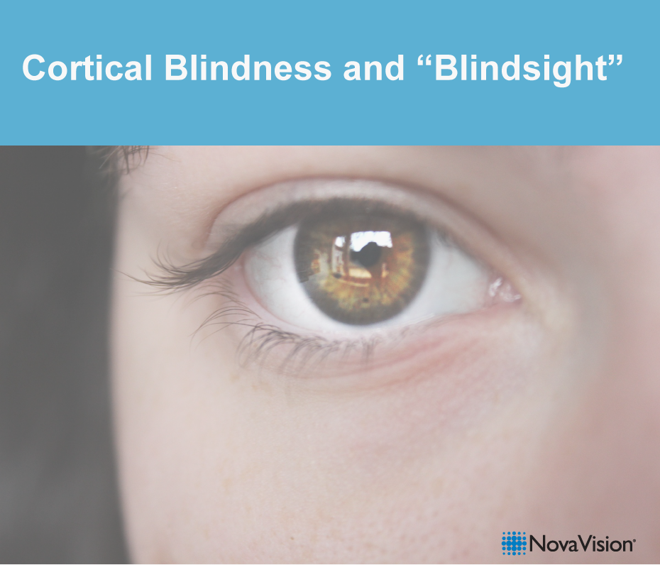 Cortical Blindness And “Blindsight”
