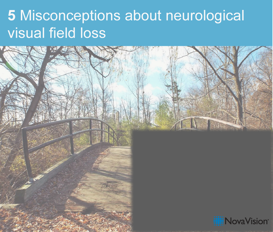 5 Misconceptions about neurological visual field loss